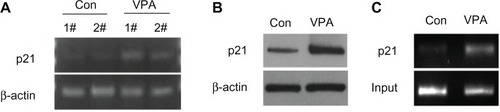 Figure 6 Valproic acid upregulates p21 expression by enhancing acetylation of histone H3 in p21 promoter region. Comparison between control group and valproic acid group after two weeks of treatment. (A) Detection of p21 expression by reverse transcriptase polymerase chain reaction. (B) Detection of p21 expression by Western blotting. (C) Detection of histone H3 acetylation level in p21 promoter by chromatin immunoprecipitation.