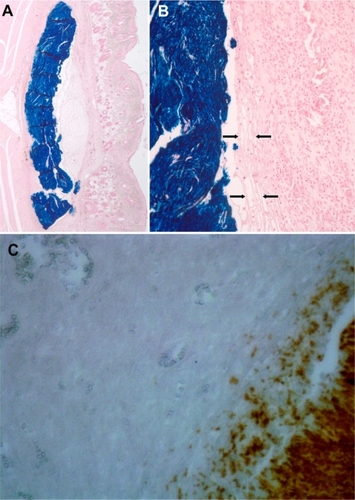 Figure 4 Histological findings of the superparamagnetic iron oxide nanoparticle-albumin complex three days after implantation and heat treatment in an electromagnetic field for 60 seconds. (A) Scanning magnification shows implant smoothly accommodated along the cleavage plane of subcutaneous fascia and axial musculature with no significant space-occupying effect. (B) Detailed view of implant/ tissue interface indicates this to consist of a narrow rim of fibrinoid exudate (arrows) surrounded by granulation tissue. Prussian Blue staining; original magnification (A) 15× and B 100×. In (C), active caspase-3 antibody staining shows no apoptotic activity around the implant (40×). Sham not shown because no difference was detected.