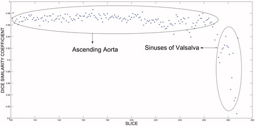 Figure 10. Decrease in Dice similarity coefficient in the region near the heart.