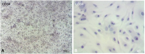 Figure 4 Immunophenotypic analysis of MSCs at the first passage revealed under light microscope show that the MSCs were negative by cell stained with blue color.
