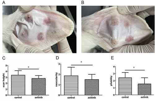 Figure 2 The inhibitory effect of axitinib on HS in a rabbit ear was observed from gross view. (A and B) The scar tissue was less conspicuous in axitinib group (B) than that in control group (A). (C–E) In comparison with HS in the control group, scar thickness (C), vascularity (D) and pliability (E) of HS was significantly decreased in the axitinib group (n = 40 per group). *P < 0.05.