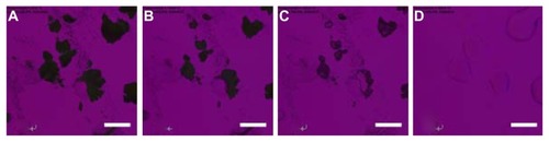 Figure 8 Representative cross-polarized light optical microscope images for the phase transitions of spray-dried cyclosporine A at a 10% pump rate. The samples were heated from 25°C to 200°C at 5°C/minute. The temperature for each graph is (A) 25°C; (B) 146.8°C; (C) 152°C; and (D) 188°C.Note: Scale bar represents 0.2 mm.