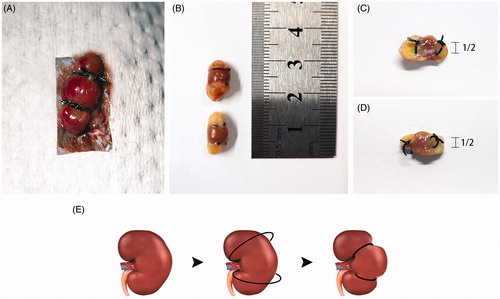 Figure 1. Unilateral kidney ligation leads to necrosis of upper and lower poles of kidney after 1 week. (A) The operation manner of l-PNx model. (B) After 1 week, the upper and lower poles of kidney have been necrotic by ligation. (C,D) Ligation of the upper and lower poles with sutures till the diameter of coil was 1/2 of the kidney. (E) Diagrammatic presentation of l-PNx model.