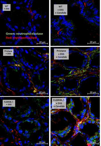 Figure 6 Representative picture of immunofluorescent stained sections for neutrophil extracellular traps (NETs) in colons as determined by neutrophil elastase (NE) (green color of Alexa Fluor 488) and myeloperoxidase (MPO) (red color of Alexa Fluor 647) of mice from wild-type (WT), Pristane and FcGRIIB-/- groups after the administration of dextran sulfate solution (DSS) alone or with Candida gavage (DSS + Candida) (original magnification 630x) are demonstrated. Colon pictures from mice with control water in WT, Pristane and FcGRIIB-/- group are not presented due to the similarity to the represented pictures of WT+DSS.