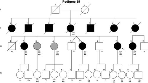 Figure 2 Pedigree of family 35. Filled black symbols, grey symbols, and empty symbols represent diabetic patients, impaired glucose tolerance individuals, and healthy individuals, respectively. The present age of the individuals are shown below the symbols in years (y), followed by age of diagnosis in years, and genotype. Genotypes are expressed by normal allele (N) and mutated allele (M); An arrow indicates the index case.
