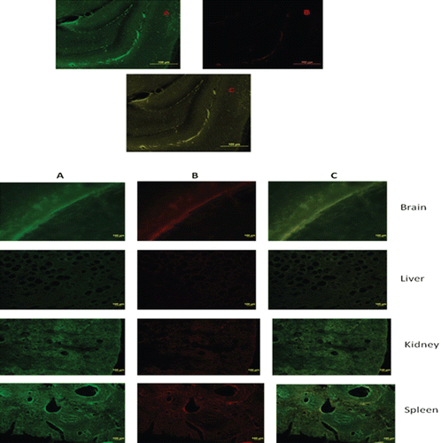 Figure 6.  Immunofluorescence confocal imaging of animal tissue after exposure to (A) FD4 saline solution, (B) Peglyated nanoparticles containing FD4, (C) Antibody-coated pegylated nanoparticles containing FD4. Green: FD4, Red: Secondary antibody associated with TRITC.