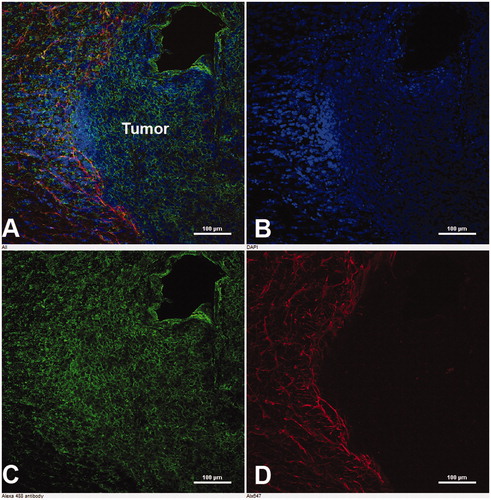 Figure 3. Immunohistochemical analysis of BSAT1 on brain slices of the experimental glioma 101/8. (A) Merged image. (B) Nuclei of cells stained with DAPI. (C) Immunofluorescence of BSAT1 in the tumor. (D) Immunofluorescence of GFAP in the peritumoral area of the astroglial bank. Laser scanning confocal microscopy. Scale bar, 100 µm.