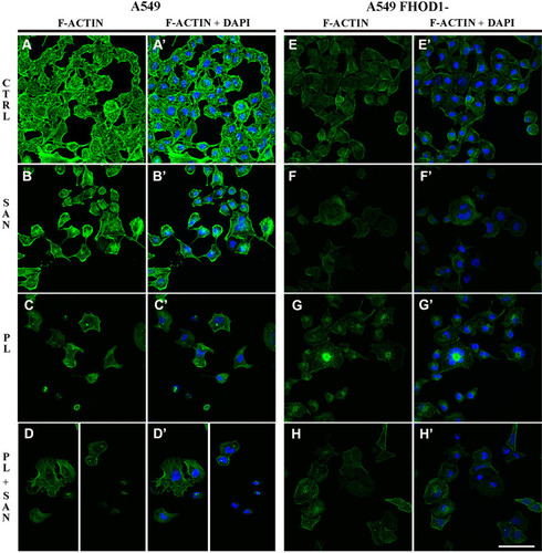 Figure 2 The effect of FHOD1 downregulation on actin network of non-small cell lung cancer A549 cells. A549 cells with the naïve expression of FHOD1 (A549) (A,A’–D,D’) and after transfection with siRNA against FHOD1 (A549 FHOD1-) (E,E’–H, H’) were treated for 24h with 1 µM sanguinarine (SAN), 4 µM piperlongumine (PL) and their combination (PL/SAN). Fluorescent staining of actin (green) and nuclei (blue). Bar = 50µm.