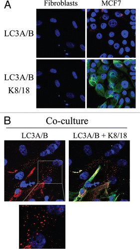 Figure 11 Possible role of stromal autophagy in decreasing mitochondrial mass in co-cultured fibroblasts. (A and B). hTERT-fibroblast-MCF7 cell co-cultures and corresponding mono-cultures were fixed and immunostained with anti-LC3 (red) and anti-K8/18 (green) antibodies. DAPI was used to stain nuclei (blue). (A) None or very little LC3A/B staining is detected in homotypic cultures of fibroblasts and MCF7 cells. (B) Note that LC3 is localized to autophagocytic vesicles in co-cultured fibroblasts, suggesting that mitochondrial loss could be mediated by autophagy. Original magnification, 63x.