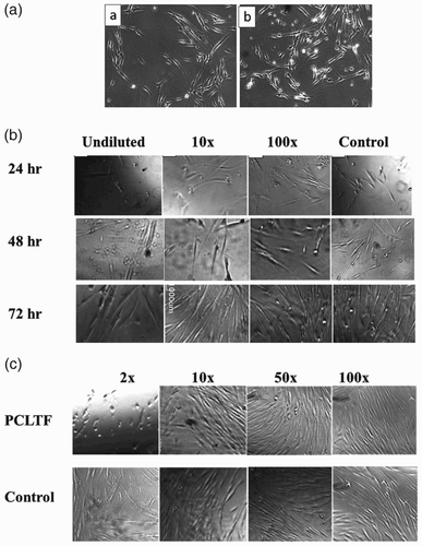 Figure 4. Phase-contrast micrograph showing the spindle-shaped ﬁbroblastic morphology of A) (a) control and (b) poly(caprolactone-trifumarate) (PCLTF) disc treated cells (scale bar = 2 mm); B) extract products after cultivation at different time intervals; and C) degradation in different dilutions with cultivation for 24 h.