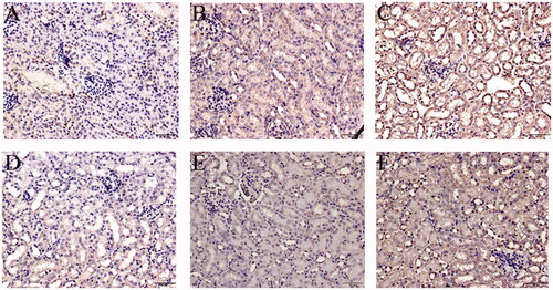 Figure 10. Local expression of TNFR1 in mice kidneys. (A) Blank control, (B) Vehicle control, (C) TCE+, (D) TCE−, (E) TCE + R7050+, (F) TCE + R7050− mice. Magnification 400×. Scale bars = 50 μm. Representative DAB staining pattern from each group are shown.