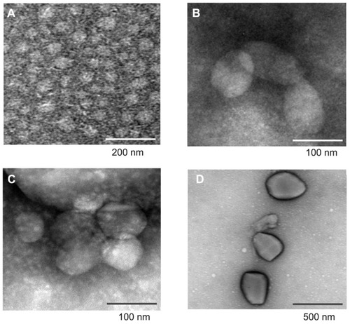 Figure 3 Transmission electron microscopy images of (A) deoxycholic acid-modified chitosan nanoparticles and triamcinolone acetonide acetate/deoxycholic acid-modified chitosan nanoparticles with different triamcinolone acetonide acetate-loading capacities, ie, (B) 12%, (C) 29%, and (D) 82%.