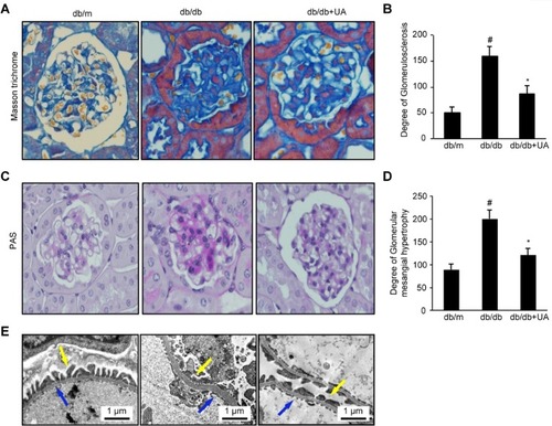 Figure 2 UA treatment reduces renal histological changes in db/db mice. (A) Images of Masson’s trichrome staining of kidney tissues from 20-week-old mice (×400). (B) Semiquantitative analysis of the GSI as determined by Masson’s trichrome staining. (C) Images of PAS staining of kidney tissues from 20-week-old mice (×400). (D) Semiquantitative analysis of glomerular mesangial matrix hypertrophy as determined by PAS staining. (E) Electron microscopy images of basement membrane thickness (blue arrow) and the degree of podocyte foot process effacement (yellow arrow). #p<0.01 compared with db/m mice and *p<0.05 compared with diabetic db/db mice. db/m group, n=10; db/db group, n=10; and db/db+UA group, n=10.