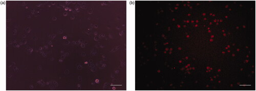 Figure 9. (a) Phase contrast images of human normal cell lines (HaCat) after incubation for 24 h under UV light. (b) Fluorescence image of human normal cell lines (HaCat) after incubation for 24 h in the presence of CP + DOX + ZnO + UV. Cytoplasm of live cells is shown in red. Scale bar indicates 50 µm.