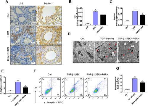 Figure 4 PGRN reduces airway autophagy in asthmatic mice and TGF-β1-treated BEAS-2B cells. (A) LC3 and Beclin-1 expression in airway tissues of mice was assessed by immunohistochemistry. (B and C) Semi-quantitative analysis showed that PGRN significantly decreased the expression levels of LC3 and Beclin-1 in mice exposed to HDM. (D) Representative TEM images of autophagosomes (red arrows) in TGF-β1-induced BEAS-2B cells with PGRN treatment or not. Scale bar=500nm. (E) Quantification of the numbers of autophagosomes in cells. (F) Apoptosis of cells was measured by the FITC-annexin V/PI assay. (G) Flow cytometry indicated that PGRN reduced apoptotic cell death in TGF-β1-treated cells. For analysis of immunochemistry assay, results are pooled from 5 random areas with four mice per group. Data are expressed as means±SEM of three independent experiments. #p<0.05 vs control group, ##p<0.01 vs control group, *p<0.05 vs HDM group, Δp<0.05 vs TGF-β1 (48h) group.