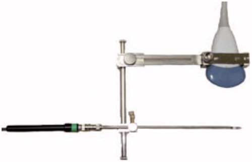 Figure 1. The abdominal ultrasound adapter specifically designed and manufactured for transcervical puncture.