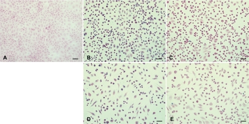 Figure 3 Prussian blue stained and nucleus fast red counterstained HUVECs incubated without or with different IONP samples. (×200 magnification).Notes: (a) Control: without any particles; (b, d) with citrate-IONP; (c, e) with dextran-IONP; (b, c) cells were incubated with IONPs at iron concentration of 0.1 nM; (d, e) cells were incubated IONPs at iron concentration of 1 nM.Abbreviations: HUVECs, human umbilical vein endothelial cells; IONP, iron oxide nanoparticles.
