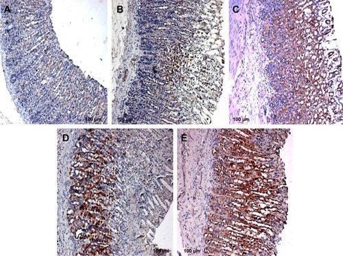 Figure 7 Rat gastric tissues showing TGF-β protein expression.