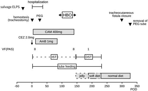 Figure 2. Clinical course of the case. The day on which the patient was transported to our hospital and hemostasis was performed was defined as day 0. ELPS, endoscopic laryngopharyngeal surgery; PEG, percutaneous endoscopic gastrostomy; HBO, hyperbaric oxygen therapy; CAM, clarithromycin; CEZ, cefazolin; AmB, amphotericin B; VF, videofluorography; PAS, penetration-aspiration scale; IST, indirect swallowing training; DST, direct swallowing training; POD, postoperative day.