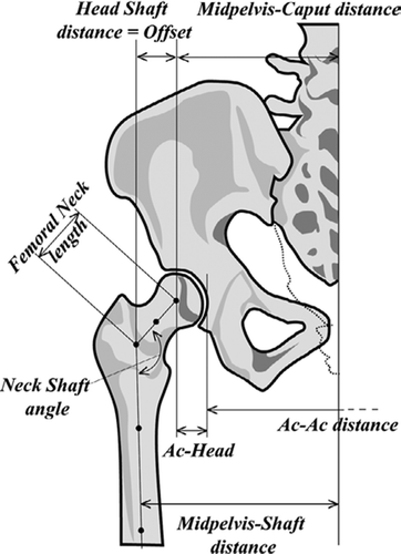 Figure 4. Reconstruction of angles and distances reconstructed in the pelvic and hip regions.