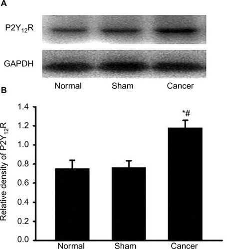 Figure 2 Cancer-induced bone pain increases P2Y12R expressions in spinal dorsal horn.