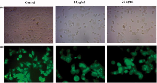 Figure 6. Mitochondrial membrane potential of HCT-116 cells exposure of AuNPs determined by fluorescent dye Rhodamine-123. (A) Morphological images of control and Au-T. kirilowii-treated HCT-116 cells. (B) Mitochondrial membrane potential of HCT-116 cells