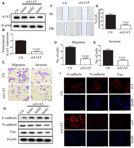 Figure 2 A1AT silencing inhibits NSCLC metastasis in vitro. (A, B) A1AT expression in A549 cells transfected with A1AT short interfering RNA (siRNA) or control siRNA (Ctl) by Western blot (A) and quantitative PCR (B). Si#01, Si#02, Si#03 indicate the three siRNAs used for the RNA interference. (C–E) Cell migration was monitored in transwell assays and matrigel transwell assays in A1AT-silenced and control A549 cells (scale bar, 100 μm). Representative images (C) and quantitation (D, E) are shown. (F, G) Analysis of the effects of A1AT knockdown on cell migration in wound-healing assays (scale bar, 500 μm). Representative images (F) and quantitation (G) are shown. (H, I) Analysis of the expression of E-cadherin (epithelial marker) and vimentin and N-cadherin (mesenchymal markers) in A1AT-silenced and control cells by Western blotting (H) and immunofluorescence staining (I); scale bar, 50 μm.