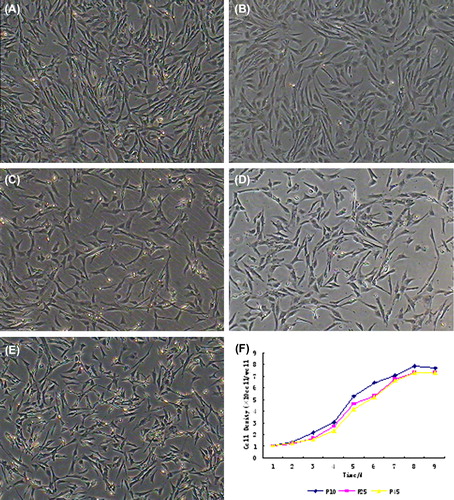 Figure 1. Morphology and growth curves of BMMSCs (100×) at (A) P5, (B) P15, (C) P25, (D) P35, (E) P45, and at (F) passages 10, 25 and 45 for comparison. The cells expanded easily and exhibited fibroblast-like morphology. The growth curves of BMMSCs at different passages were S-shaped, and the PDTs of BMMSCs were 30.21, 31.78, 35.19 and 35.87 hr respectively.