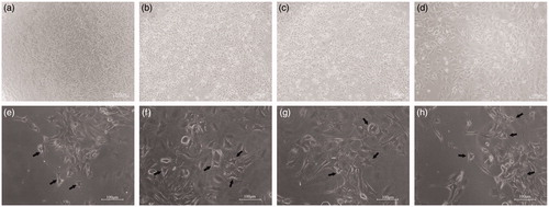 Figure 2. Morphology of neural progenitor C17.2 cells cultured in proliferation medium (a–d) or differentiation medium (e–h) for 6 days. Control cells (a), cells exposed to 1 μg/mL (b), cells exposed to 10 μg/mL (c) and cells exposed to 20 μg/mL (d) of crude venom dissolved in the proliferation medium. Control cells (e), cells exposed to 1 μg/mL (f), cells exposed to 10 μg/mL (g) and cells exposed to 20 μg/mL (h) of crude venom dissolved in differentiation medium.Note: Phase contrast images. Scale bar 100 μm.