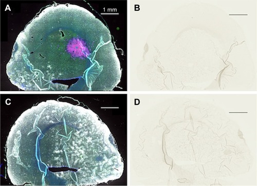 Figure 3 Complete lack of gold enhancement in saline-injected rats.Notes: (A) Left hemisphere, fluorescence; (B) left hemisphere, gold enhance; (C) right hemisphere, fluorescence; and (D) right hemisphere, gold enhance. (A and C) mCherry red (tumor, red), anti-albumin (edema, green), DAPI (nuclei, blue), and anti-CD31 (blood vessels, white) and (B and D) gold enhanced (gold stained, black).Abbreviation: CD31, cluster of differentiation 31.