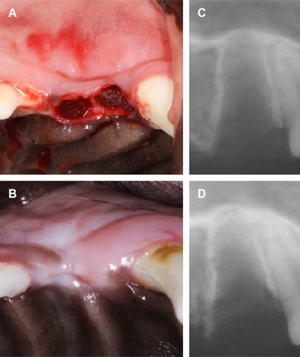 Figure 7 Implantation of GO scaffold to extraction socket.Notes: (A) Photograph of implanted scaffold. (B) Macroscopic view at 2 weeks postsurgery. (C) Radiographic images immediately after operations. (D) Radiographic image at 2 weeks postsurgery. The socket applied with GO scaffold showed increased radiopacity.Abbreviation: GO, graphene oxide.