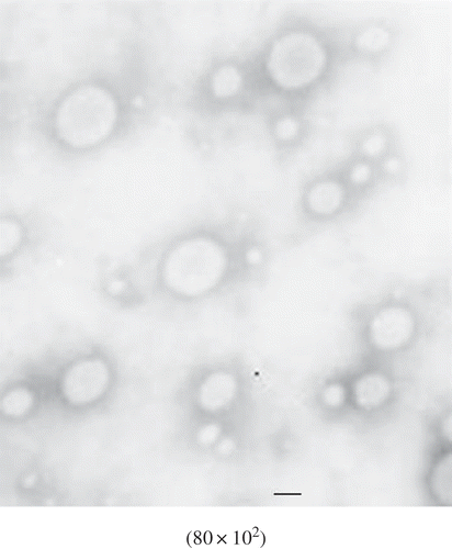 FIGURE 1 TEM picture of MCFAs-Vit.C complex liposomes by double emulsion. The bar represents 200 nm.