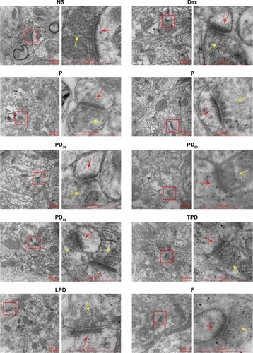 Figure 7 The ultrastructure of hippocampal neurons as revealed by TEM.