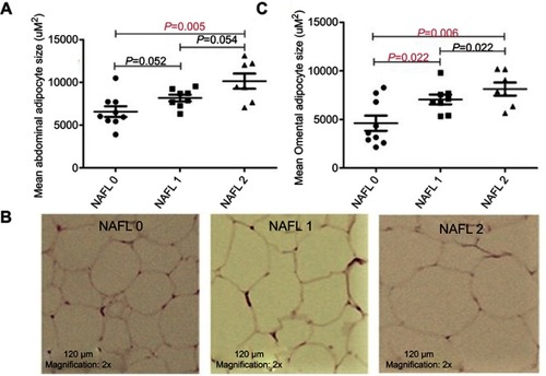 Figure 2 Mean adipocyte size in participants with varying degree of nonalcoholic fatty liver (NAFL). (A) Participants with NAFL 2 had a significantly higher abdominal adipocyte area as shown by post-hoc analyses, which also indicate increases in abdominal adipocyte area between NAFL 0 and NAFL 1 and NAFL 1 and NAFL 2 that are trending significance. (B) Representative H&E-stained sections of abdominal adipose tissue (subcutaneous) are shown for each group. (C) Participants with fatty liver had a significantly higher omental (visceral) adipocyte area as shown by post-hoc analyses, which indicate a significant increase in adipocyte area between NAFL 0 and NAFL 1, but not between NAFL 1 and NAFL 2. Hepatic steatosis was assessed using ultrasound. Adipocyte area was measured using the ImageJ software. n=10–13 per group. ANOVA with Bonferroni–Holm corrections analyses was performed.