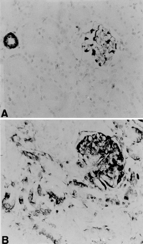 Figure 2. Immunolocalization of vimentin in the renal cortex of a rat killed on day 18 after treatment with 3.5 mg/kg adriamycin (B) and of a control rat (A). Note that the immunostaining in tubular cells is more intense in B. ×420.