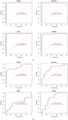 Figure 8. Validation of the diagnostic value of the hub genes. (a) Evaluation of the key genes of GSE108109 and GSE200828. ROC curves with AUC were provided to verify the ability to differentiate the glomerulus of FSGS from that of the control group based on sensitivity and specificity. (b) Evaluation of TGFB1 and NOTCH1 in GSE129973. These results were similar to those of GSE108109 and GSE200828. ROC: receiver operating characteristic; AUC: area under the curve.