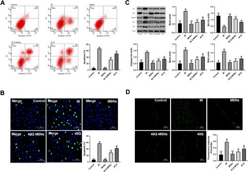 Figure 2 Effect of Q-MSNs on apoptosis and oxidative stress of hypoxia/reoxygenation myocardial cells. (A) Cell apoptosis in each group determined by annexin V/PI staining. There was inhibition on cell apoptosis in both Q group and Q-MSNs group. At the same concentration, the inhibitory effect in the 40Q-MSNs group was better, and silica nanoparticles alone had no effect on apoptosis. (B) Cell apoptosis in each group determined by Tunel staining. There was inhibition on cell apoptosis in both Q group and Q-MSNs group. At the same concentration, the inhibitory effect in the 40Q-MSNs group was better. (C) Apoptosis-related proteins in cells determined by Western blotting.There was regulation on apoptosis-related proteins in cells in both the Q group and Q-MSNs group, and at the same concentration, the regulation effect in the 40Q-MSNs group was better. (D) Reactive oxygen species (ROS) in each group. There was inhibition on the production of ROS in cells in both Q group and Q-MSNs group, and at the same concentration, the inhibitory effect in the 40Q-MSNs group was better.