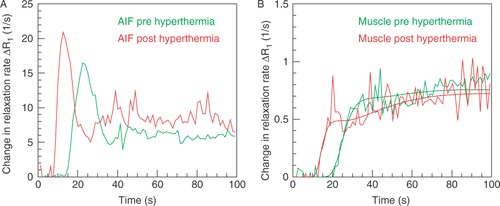 Figure 1. Two arterial input functions (A) and tissue functions (B) in units of the change in relaxation rate ΔR1 determined from a peripheral artery in a sarcoma patient 4 days before (green) and 20 min after the first hyperthermia treatment (red). The change in relaxation rate which was calcuated by substracting the baseline relaxation rate is proportional to the tracer concentration. Images were acquired with a 3D spoiled gradient echo sequence. Baseline images were acquired using flip angles of 5°, 10°, 20°, 30°, and 40°; TR = 3.64 ms, TE = 1.21 ms. The dynamic scan was acquired using the same sequence with a flip angle of 30° starting with the injection of 20 ml gadoteridol bolus over 5 s. (A) Following hyperthermia, the delay of the AIF is reduced by 9.3 s and the apparent transit time of the AIF from 12.52 s to 7.58 s. (B) The change in relaxation rate in tissue is proportional to the tracer concentration determined. Perfusion is calculated by using a one-compartment model, which provides a tendency and rough estimation of the true perfusion value. The two fit functions are indicated by dots.