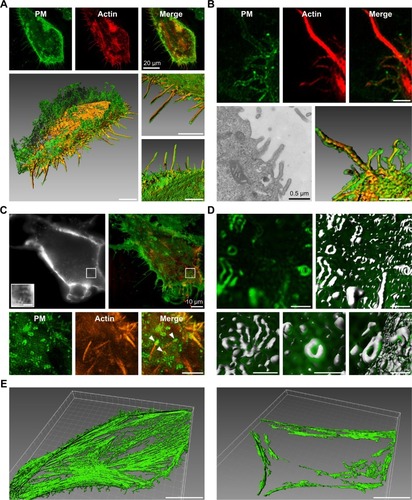 Figure 4 Lamellipodia and ruffles of macropinocytosis by real-time imaging based on super-resolution structured illumination microscopy.Notes: (A) K-rasG12C MIA PaCa-2 cell membrane was stained with WGA 488; fluorescent actin was obtained by pmApple-LifeACT-N1 plasmid transfection. Cells were imaged after FBS starvation for 18 hours. Surface rendering was generated from the Imaris software that showed cell lamellipodia. Bars, 5 µm (excluding tagged ones). (B, C) Cells were treated with 0.1 µM TPA after 18 hours starvation, with the cells stained as in (A). Both electron microscope images and others in (B) show ruffles on cell edges and in (C) show ruffles on the ventral aspect of the cell (arrowheads). Bars, 2 µm (excluding tagged ones). (D) Ruffle characteristics were obtained by Imaris analysis. Bars, 1 µm. (E) K-rasG12C MIA PaCa-2 cells were treated with 0.1 µM TPA or not after FBS starvation for 18 hours. Afterward, the cells were fixed with 4% paraformaldehyde in PBS for 20 minutes and permeabilized with 0.1% Triton for 10 minutes; F-actin was stained with ActinGreen 488. Left: With no TPA treatment, F-actin running through K-rasG12C MIA PaCa-2 cells existed steadily. Right: On the contrary, after adding TPA, K-rasG12C MIA PaCa-2 cells, ventral F-actin decreased gradually. Surface rendering of F-actin images showed K-rasG12C MIA PaCa-2 cells’ ventral characteristics. Left panel: K-rasG12C MIA PaCa-2 cells after FBS starvation for 18 hours with integrated F-actin running through the cells; right panel: K-rasG12C MIA PaCa-2 cells treated 0.1 µM TPA after FBS starvation for 18 hours with no F-actin on the ventral cell surface. Bars, 10 µm.Abbreviation: FBS, fetal bovine serum; PM, plasm membrane.