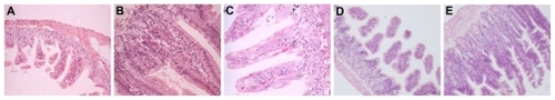Figure 6 Histopathology of intestine tissues of mice after allo-HSCT [hematoxylin and eosin, magnification ×4 (objective lens)]. (A) Control group; (B) irradiation-only group; (C) Fe3O4 MNPs-treated group; (D) CsA-treated group; (E) CsA + Fe3O4 MNPs-treated group.Abbreviations: allo-HSCT, allogenetic hematopoietic stem cell transplantation; CsA, cyclosporine A; Fe3O4 MNPs, Fe3O4 magnetic nanoparticles.