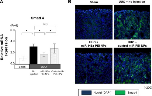 Figure 8 Effects of microRNA (miR)-146a-polyethylenimine nanoparticles (PEI-NPs) on expression of Smad4 in obstructed kidneys.Notes: (A) Quantitative real-time reverse-transcription polymerase chain reaction analysis of Smad4 expression in each group (n=6). (B) Representative immunofluorescence staining of Smad4-positive cells in the obstructed kidneys of each group (n=6). Values are mean ± standard error (error bars). *P<0.05.Abbreviations: DAPI, 4′,6-diamidino-2-phenylindole; NS, not significant; UUO, unilateral ureteral obstruction.