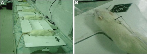 Figure 1 Rats of MCAO model were treated with EA at the “Baihui” acupoint and “Dazhui” acupoint.