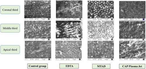 Figure 2. Representative SEM images of the samples analyzed.
