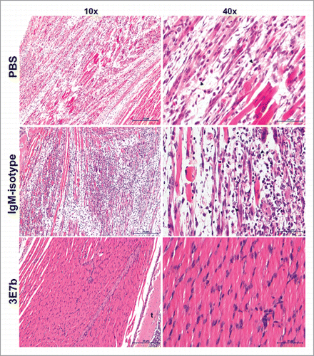 Figure 9. Histological analysis of limb muscles of mice post-treated with 3E7b after CHIKV infection. As described previously, limb muscles of infected mice at day 7 p.i. were harvested, fixed and processed for hematoxylin & eosin staining as described. Images are viewed and captured under 10× and 40× magnification of BX43 Olympus microscope. Representative images are shown with scale bar of 20 μm. Black arrowhead points to inflammatory cell. t, tendon.