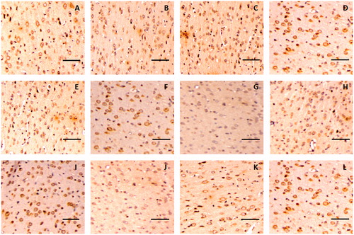 Figure 9. Representative immunohistochemical images of F-actin in the brain tissue of glioma rat after borneol exposure at different time points: (A) 5 min in the control group, (B) 30 min in the control group, (C) 45 min in the control group, (D) 2 h in the control group, (E) 5 min in the low-borneol group, (F) 30 min in the low-borneol group, (G) 45 min in the low-borneol group, (H) 2 h in the low-borneol group, (I) 5 min in the high-borneol group, (J) 30 min in the high-borneol group, (K) 45 min in the high-borneol group and (L) 2 h in the high-borneol group. Scale bars, 100 μm.