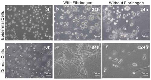 Figure 1. Optimization of bio-ink. A: Epidermal cells cultured in bio-ink at 0 h (control); B-C: Epidermal cells cultured in bio-ink with and without fibrinogen at 24 h; D: Dermal Cells cultured in bio-ink at 0 h (control); E-F: Dermal Cells cultured in bio-ink with and without fibrinogen at 24 h.