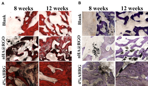 Figure 11 Histological analysis of the defect sites in different experimental groups at different time points: (A) HE staining, (B) TB staining.