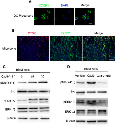 Figure 5 Cxcl9 activates CXCR3/ERK signaling in osteoclasts. (A) Representative photomicrographs of immunostaining of CXCR3 in cultured BMMs. Scale bar, 20 μm. (B) Representative photomicrographs of immunostaining of CXCR3 in CTSK+ osteoclasts in mice bone. (C) Serum-starved BMM cells were incubated with 100 ng/mL Cxcl9 for the indicated time points. Total cell lysates were immunoblotted with antibodies specifically recognizing the phosphorylated form of Src and ERK. (D) Serum-starved BMM cells were incubated with Cxcl9 (100 ng/mL) or Cxcl9 plus NBI-74,330 (CXCR3 antagonist) as indicated for 10 min. Total cell lysates were immunoblotted with antibodies specifically recognizing the phosphorylated form of Src and ERK.