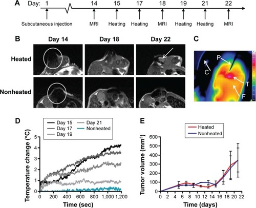 Figure 2 Murine model of OVCAR-3 tumor growth, with and without magnetic heating.Notes: (A) Experimental plan of MRI and AMF heating. (B) T2 weighted MR images of a heated and nonheated OVCAR-3 tumor coinjected with Ferucarbotran-labeled MSCs, at days 14 (prior to heating), 18, and 22 (postheating) (white arrow indicates signal recovery). (C) Thermocamera image of a heated tumor (T) on the flank of a nude mouse (F) with C indicating the MACH coil and P the fiber-optic thermometry probe. (D) Fiber-optic thermometry measurements of a heated tumor over days 15, 17, 19, and 21 and a representative nonheated tumor and core body temperature. (E) Post-innoculation OVCAR-3 tumor growth for both heated and nonheated tumors.Abbreviations: MRI, magnetic resonance imaging; AMF, alternating magnetic field; MR, magnetic resonance; MACH, magnetic alternating current hyperthermia; sec, seconds; MSCs, mesenchymal stem cells.