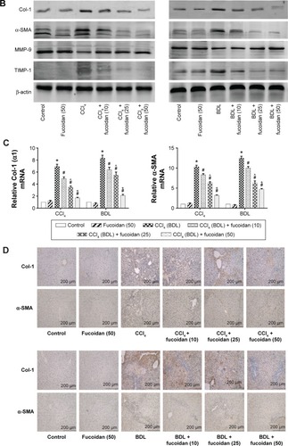 Figure 2 Effect of fucoidan on ECM in liver fibrosis.